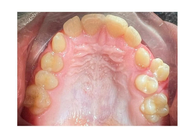 Ортодонтическое лечение